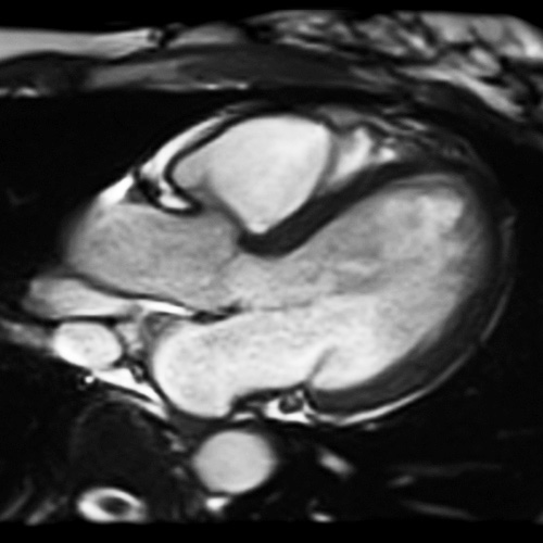 Magnetism - Questions and Answers in MRI