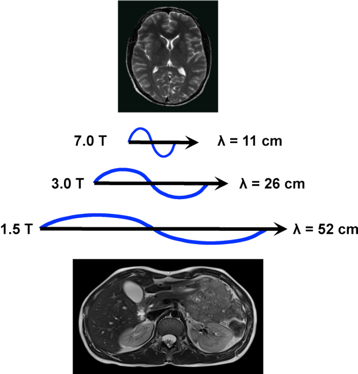 Superconductive magnet design - Questions and Answers ​in MRI