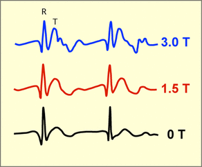EKG in magnetic fields