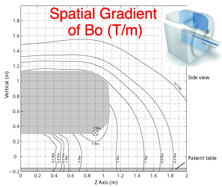 spatial gradient map MRI